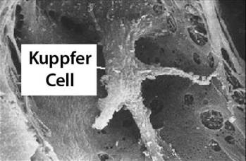 Kuppfer cells